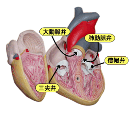 化 大動脈 石灰